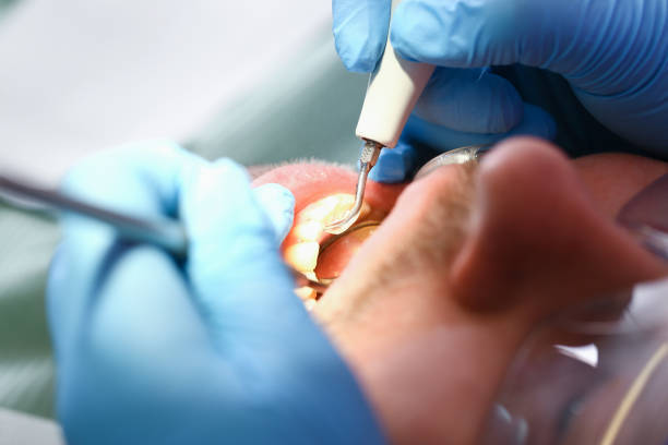 Best Walk-In Emergency Dentist in Newport, SC