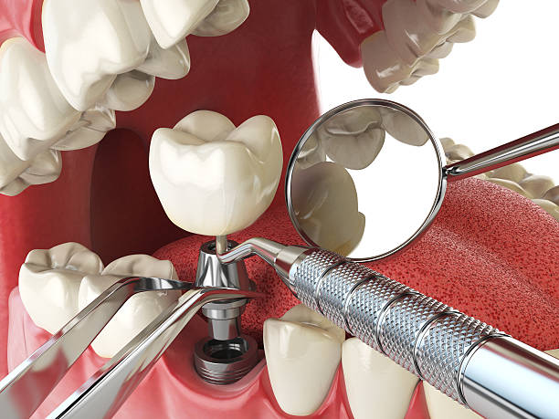 Best Emergency Treatment for Toothache in Newport, SC