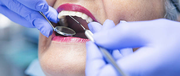 Best Emergency Root Canal Treatment in Newport, SC